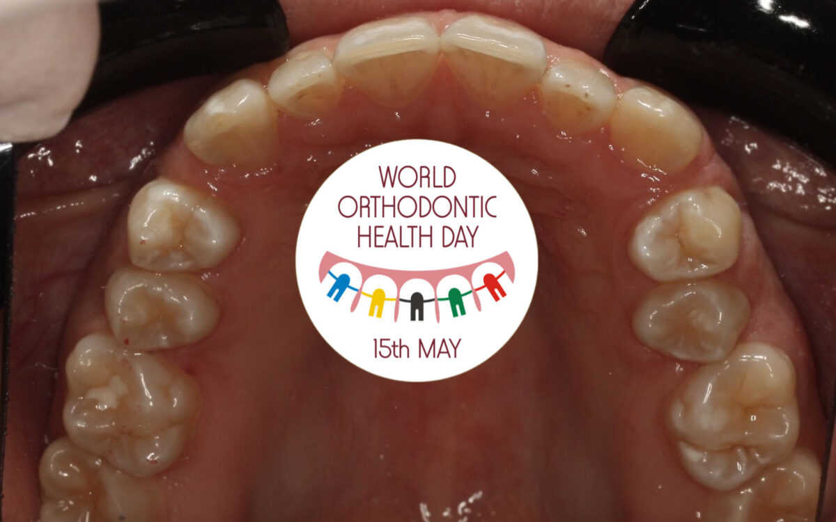 Nieoczywiste korzyści z leczenia ortodontycznego