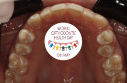 Nieoczywiste korzyści z leczenia ortodontycznego